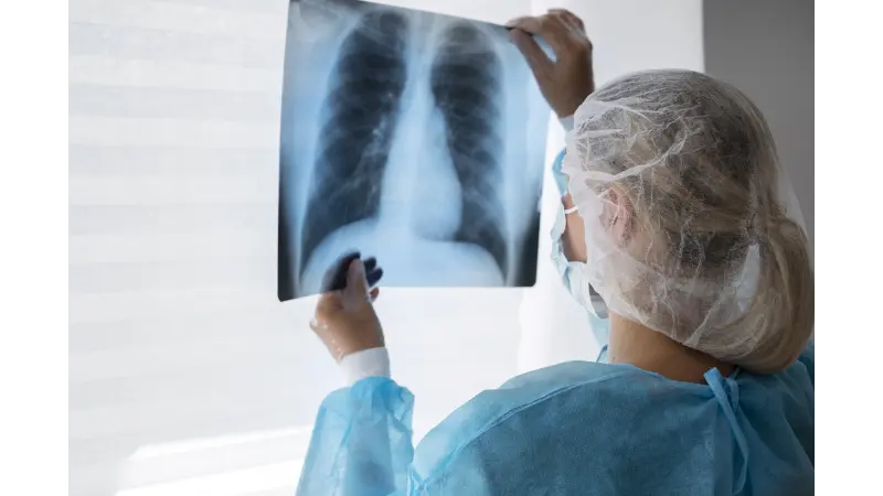 Қазақстан туберкулезді қалай жеңбек және ондағы ҮЕҰ-дардың рөлі қандай